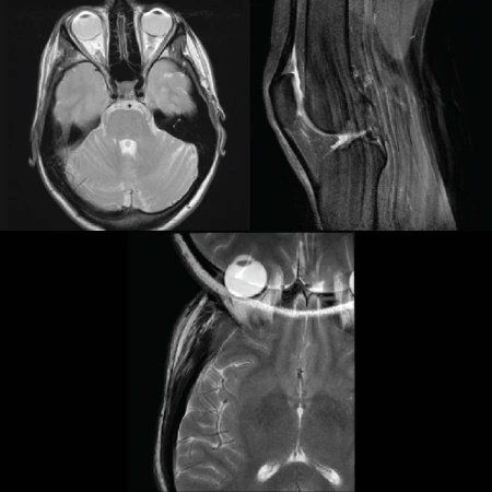 Artifacts in MRI CE Course