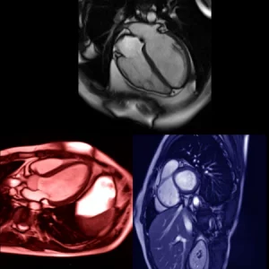 Cardiac MRI Radiology CE credits online