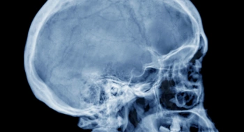 X-Ray Head Procedures - Sinuses Radiology CE / CEU Webinar