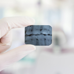 La Radioprotection des Patients: Imagerie Dentaire