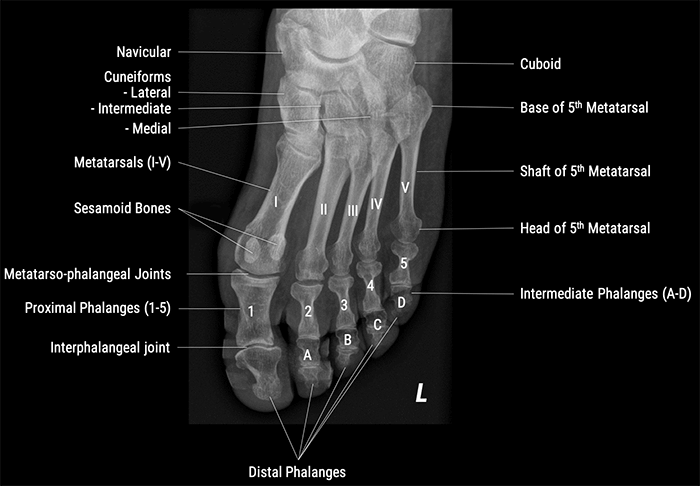 X-Ray Positioning Toes