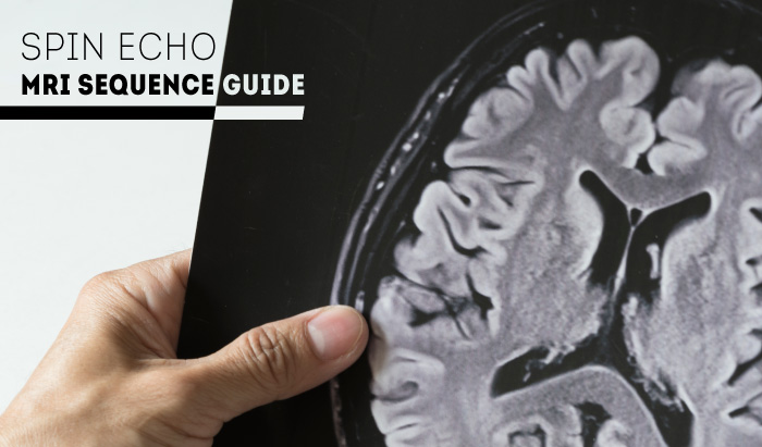 Spin Echo: MRI Guide