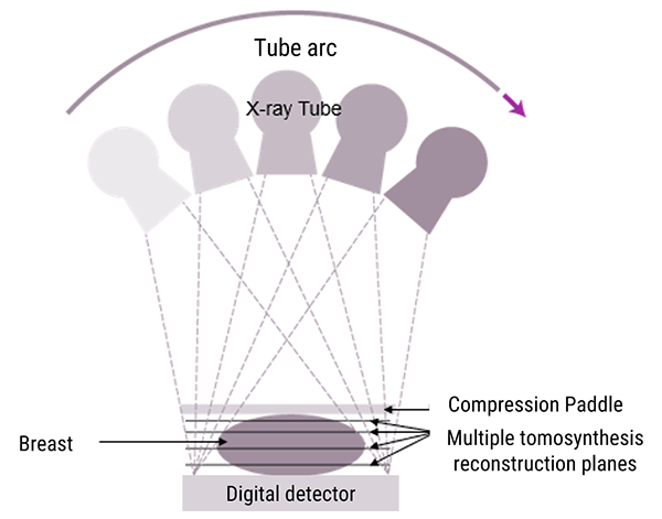 Larger Arc Options