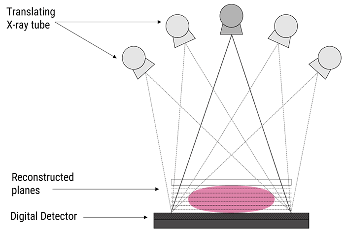 Digital Breast Tomosynthesis: An Overview to 3d mammography