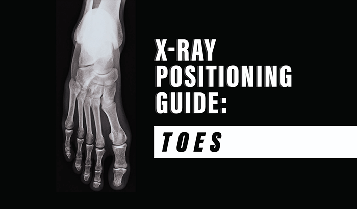 X-Ray Positioning Guide: Toes