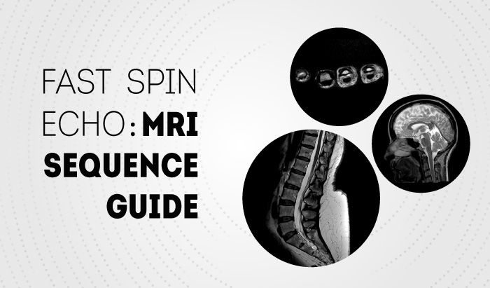 Fast Spin Echo: MRI Sequence Guide