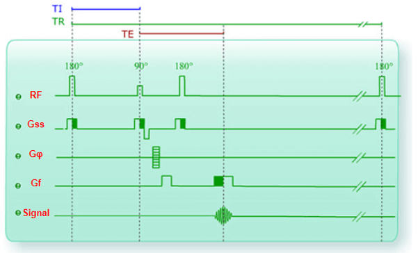 Inversion Recovery Chronogram