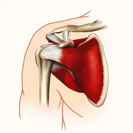 Ultrasound Assessment of the Rotator Cuff Lesions