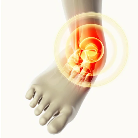 Ultrasound of the Ankle Sprains