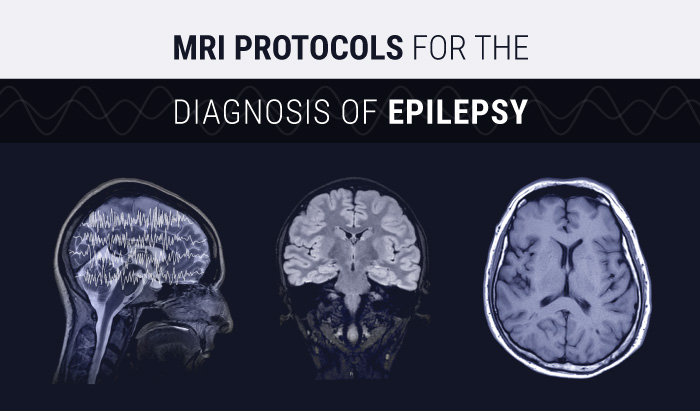 MRI Protocols for the Diagnosis of Epilepsy