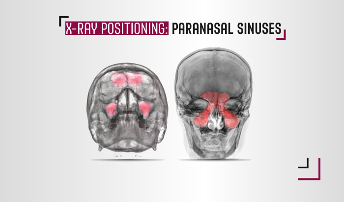 paranasal sinus x-ray views