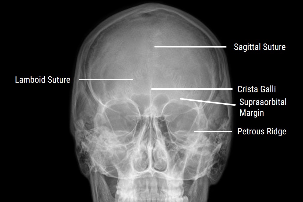 Sinus X Ray Positioning An X Ray Guide Medical Professionals