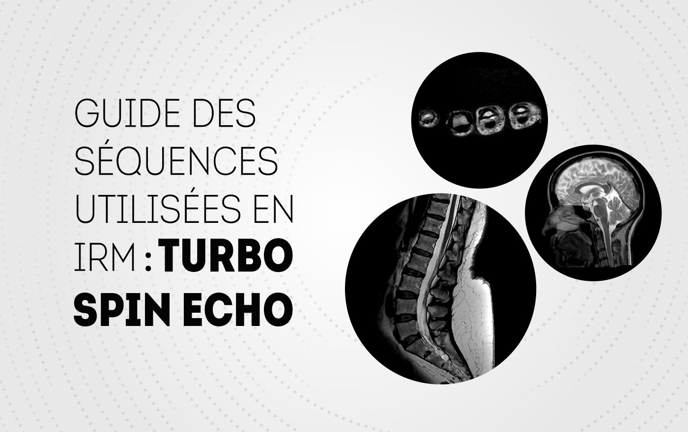 Fast Spin Echo : Guide de séquence en IRM