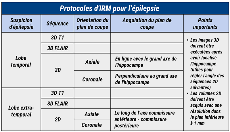 Points clés à retenir