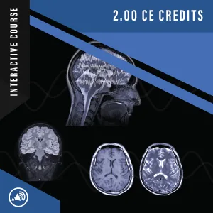 The Contributions of MRI in Epilepsy