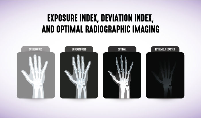 Exposure Index, Deviation Index, and Optimal Radiographic Imaging