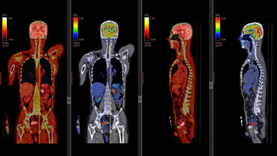 Radiation Protection in PET/CT