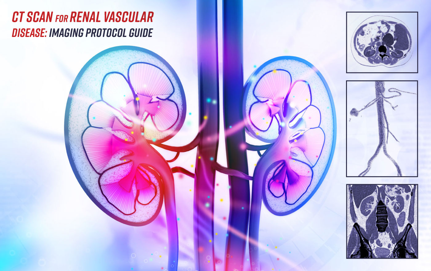 CT Scan for Renal Vascular Disease: Imaging Protocol Guide