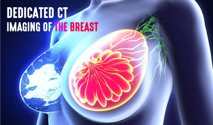 Dedicated CT Imaging of the Breast