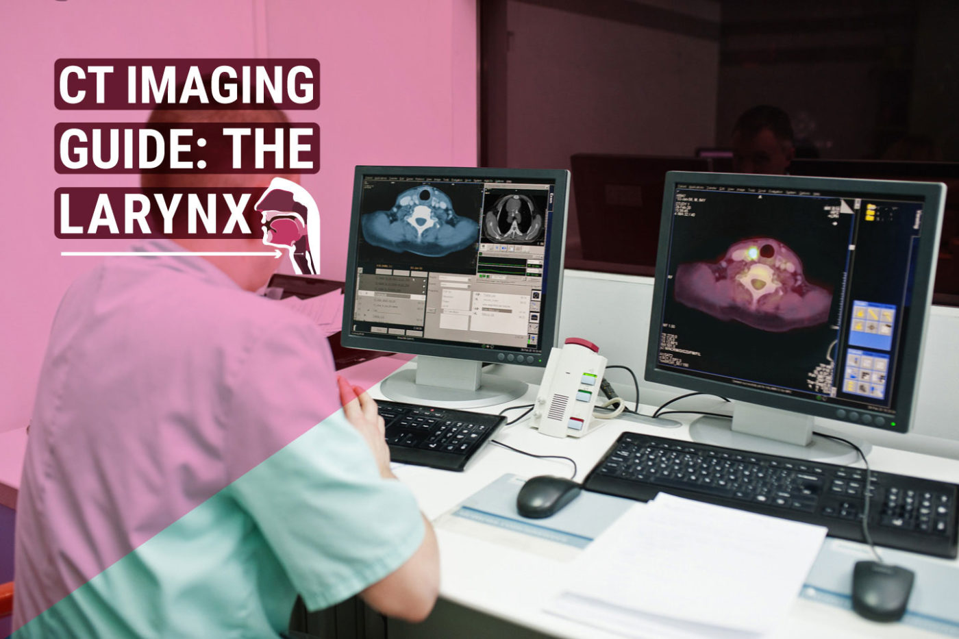 CT Imaging Guide: The Larynx