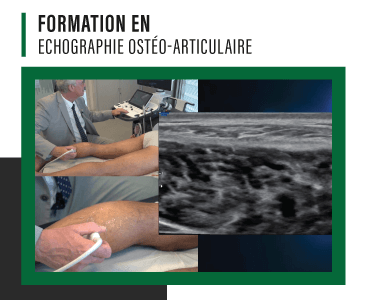 Echographie MSK