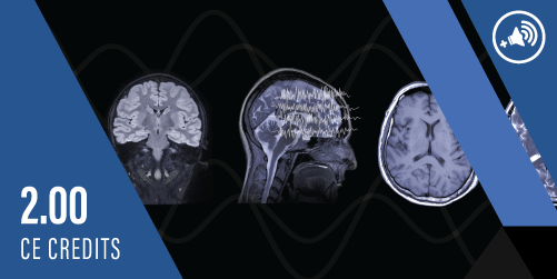 The Contributions of MRI in Epilepsy
