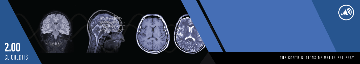 The Contributions of MRI in Epilepsy