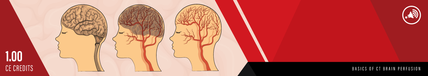 Basics of CT Brain Perfusion