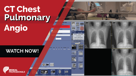 CT Chest Pulmonary Angio
