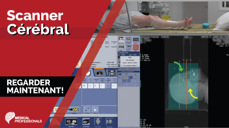 Scanner Cérébral