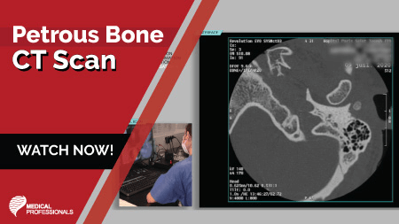 Petrous Bone CT
