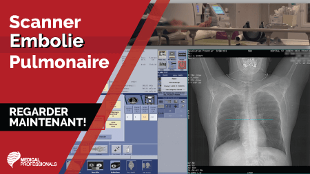 Scanner embolie pulmonaire