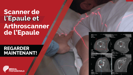 Scanner de l'epaule et arthroscanner de l'epaule