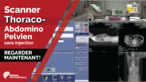 Scanner Thoraco Abdomino Pelvien sans Injection