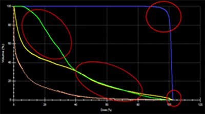 Prostate Cancer IMRT Plan Results