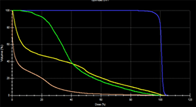 Prostate Cancer IMRT Plan Results