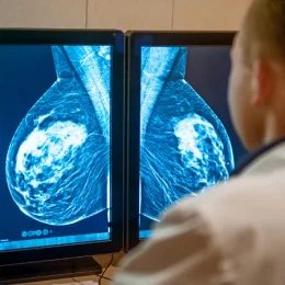 La Technique et Qualité Image en Mammographie