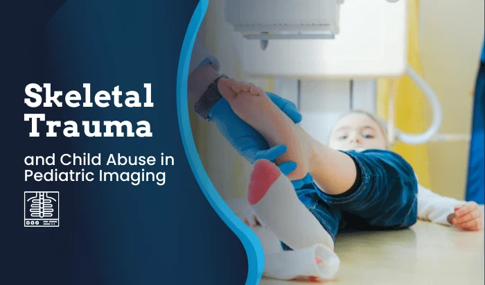 Skeletal Trauma and Signs of Child Abuse in Pediatric Imaging