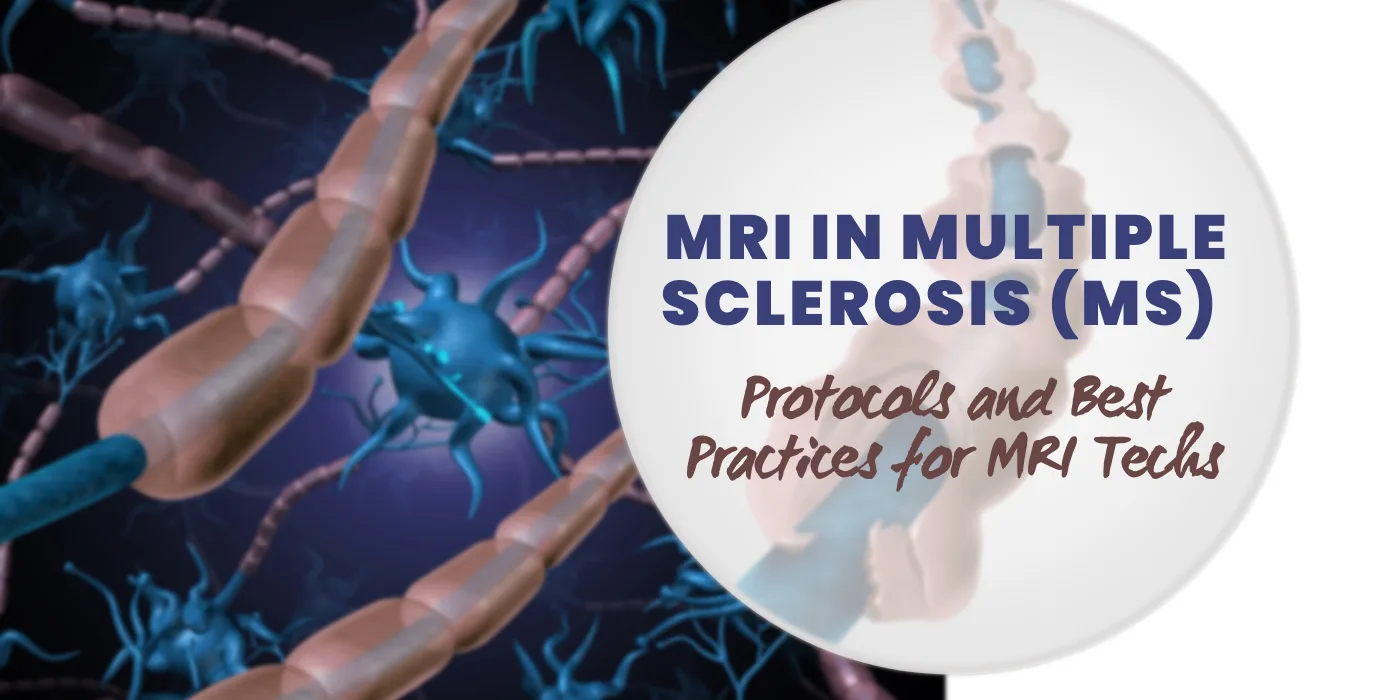 MRI in Multiple Sclerosis (MS): Protocols and Best Practices