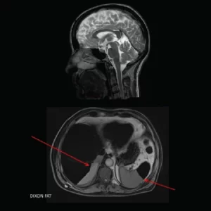 MRI Sequences and Saturation Techniques online CE Course