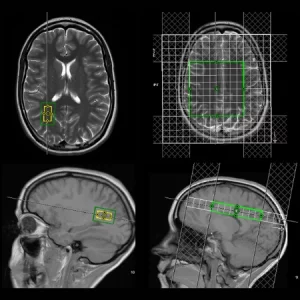 MRI Spectroscopy Basics Continuing Education Course online