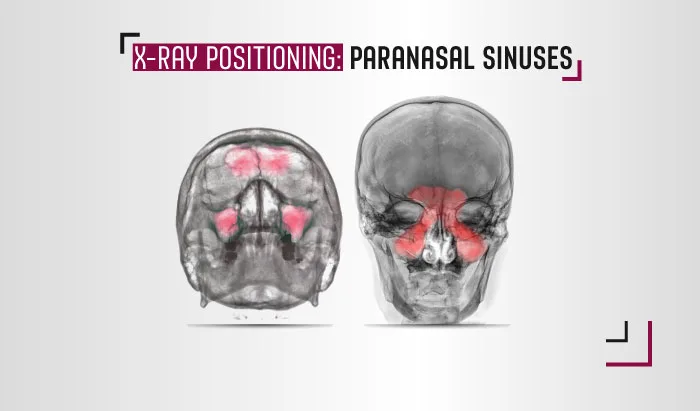 X-Ray Positioning: Paranasal Sinuses