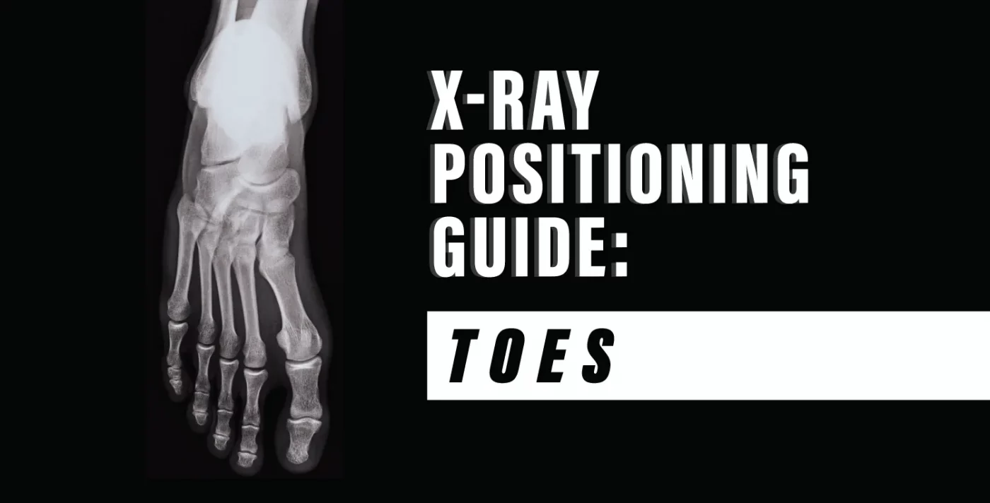 X-Ray Positioning Guide: Toes