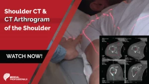 Shoulder CT and CT Arthrogram of the Shoulder