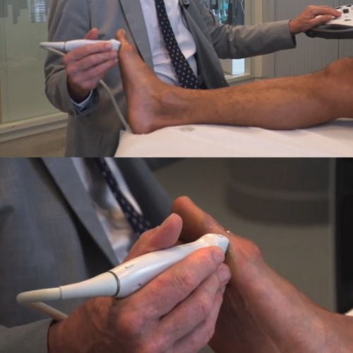 Ultrasound of the Foot