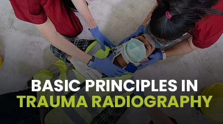 Basic principles in trauma radiography