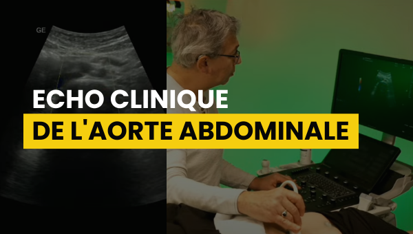 Echographie Clinique de l’Aorte Abdominale Webinaire
