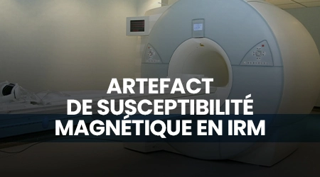 L'artefact de susceptibilité magnétique en IRM