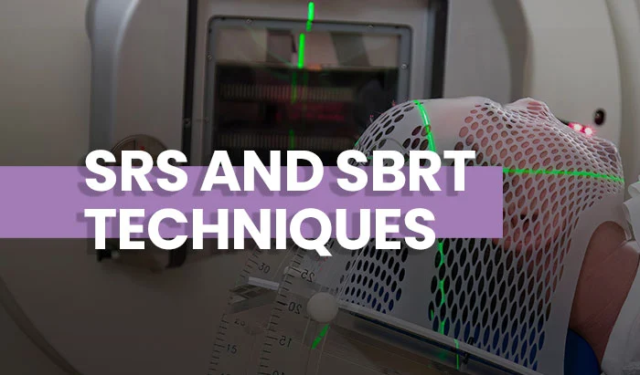 Stereotactic Radiosurgery - SRS and SBRT Techniques
